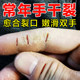Nanjing Tongrentang heels ແຫ້ງແລະຮອຍແຕກ, ປອມກໍາຈັດຜິວຫນັງທີ່ຕາຍແລ້ວ, ຄີມຕ້ານຮອຍແຕກ, ຮອຍແຕກຂອງມື, ຕີນແລະນິ້ວມືຮ້ານຄີມຢ່າງເປັນທາງການ