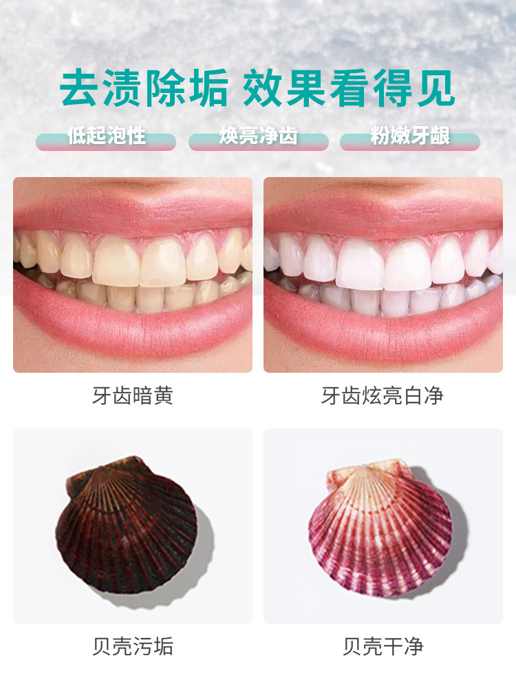 蛛王炫亮净齿精华露冻干美白牙粉 蛛王牙粉