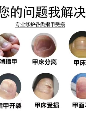 指甲游离线生长液护甲油增长液延长护理营养油养甲床分离空甲修复
