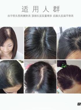 刘海发根女生头顶蓬松垫高短发假发发垫隐形自然盘发增高插发梳