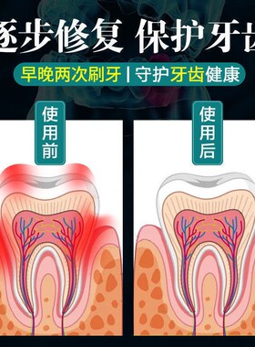 新品【重度牙龈萎缩】牙周炎专用牙膏牙齿松动修S复牙龈肿痛酸软