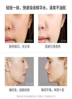 大安瓶面部精华液湿敷水米白补水保湿李佳琪琦收缩毛孔肌肽原液