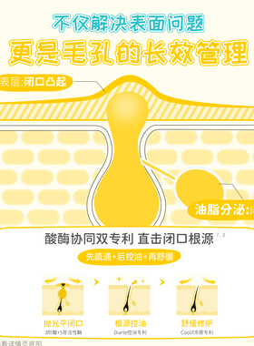 ilso去闭口祛痘控油爽肤水