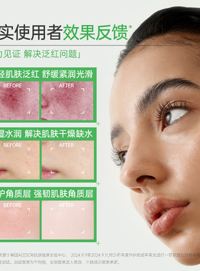 ilso一苏舒缓保湿面部精华液