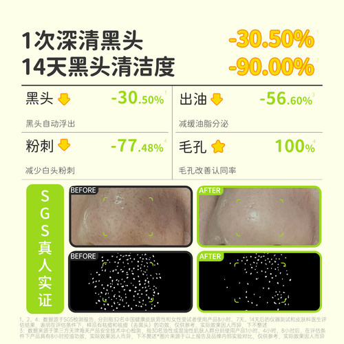 【虞书欣同款】ilso一苏x蜡笔小新韩国进口黑头导出液去白头粉刺 - 图1
