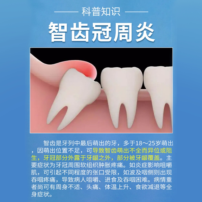 智齿牙龈肿痛消炎牙疼止疼冠周炎牙膏牙痛专用牙痛宁喷雾剂药水JW_虎窝淘