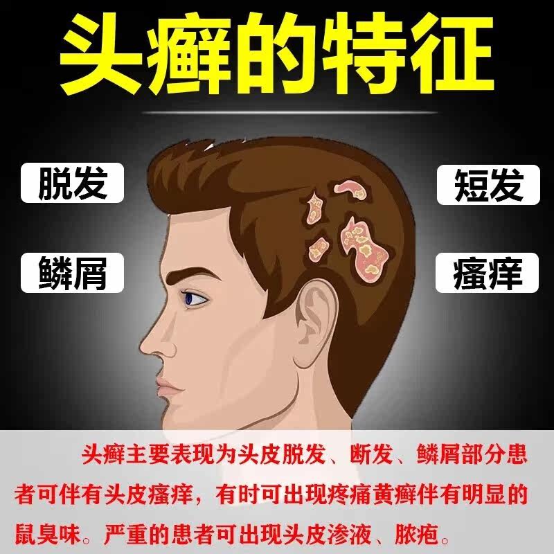  猪猪麦保健理疗