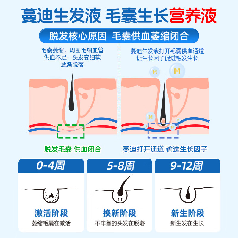 蔓迪米诺地尔酊町生发液女性男士正品防脱增发曼迪官方旗舰店90ml - 图0