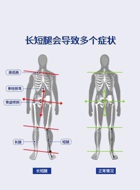 日本长短腿矫正鞋垫高低脚补高脊柱侧弯骨盆前倾高低肩调节下肢不