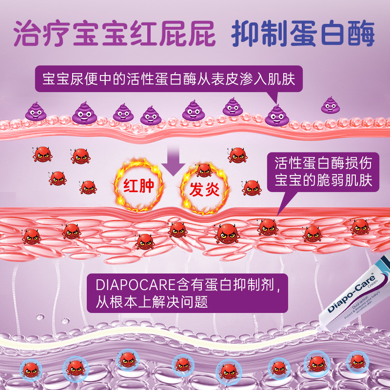 Diapocare新生婴幼儿宝宝屁屁霜保湿滋润红屁股护臀霜舒缓修护 - 图1