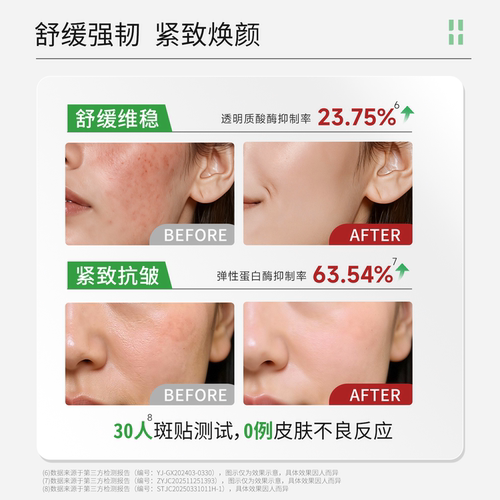 自然攻略依克多因舒敏修护面膜敏感肌改善泛红修护5片/盒 - 图1