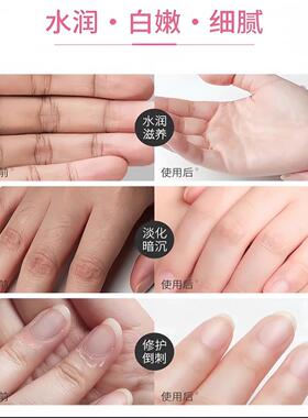 8分钟手膜急救澳洲新西兰