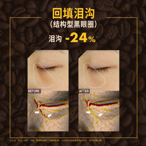 超浓维K咖啡 眼霜|50%玻色因溶液 黑眼圈眼袋眼纹 言之有物 专享 - 图2