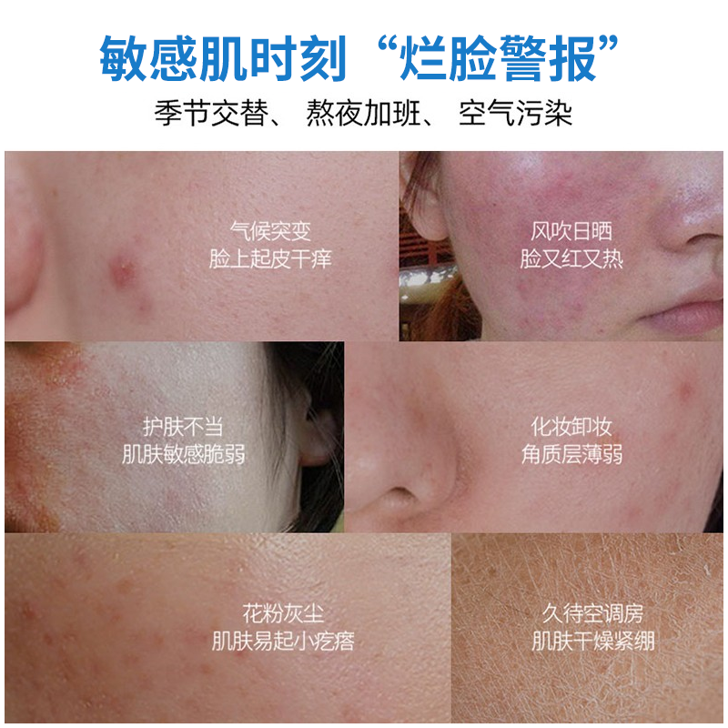 修正冷敷贴痘印敏感肌痘肌修护面膜 大光明大药房面部健康