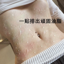 (Tongrentang Ai Navel Paste) Sleep Before Sleeping With a Lean Back Attack Small Waist Essence Sloth to collect the belly and buy three delivery two