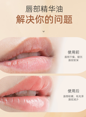 李佳琪护唇油玻璃唇女保湿滋润去死皮淡化唇纹补水防干裂润唇