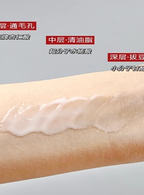 达尔肤点痘笔杏仁酸精华乳