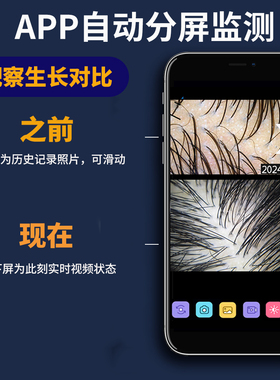 可视化头皮上药器高清导液按摩梳