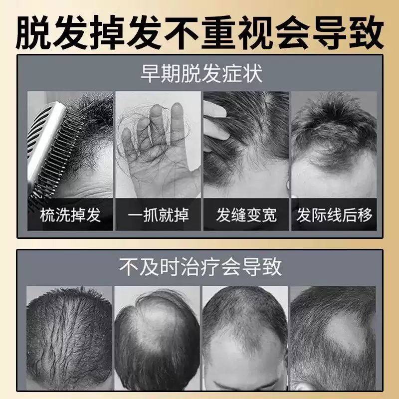 特伶生发片36片黑发白发脱发补肾脱发增发乌发米诺地尔滋补肝肾,淘宝优惠券,粉丝福利购,淘宝优惠卷