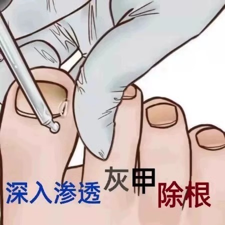 【同仁堂热卖】无痛换新钾 享受好甲生活 坏甲变好jia 滴一滴 - 图1