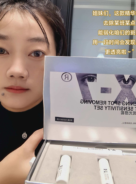 X7美白祛斑光感套盒F1斑王美白祛斑痘印提亮肤色