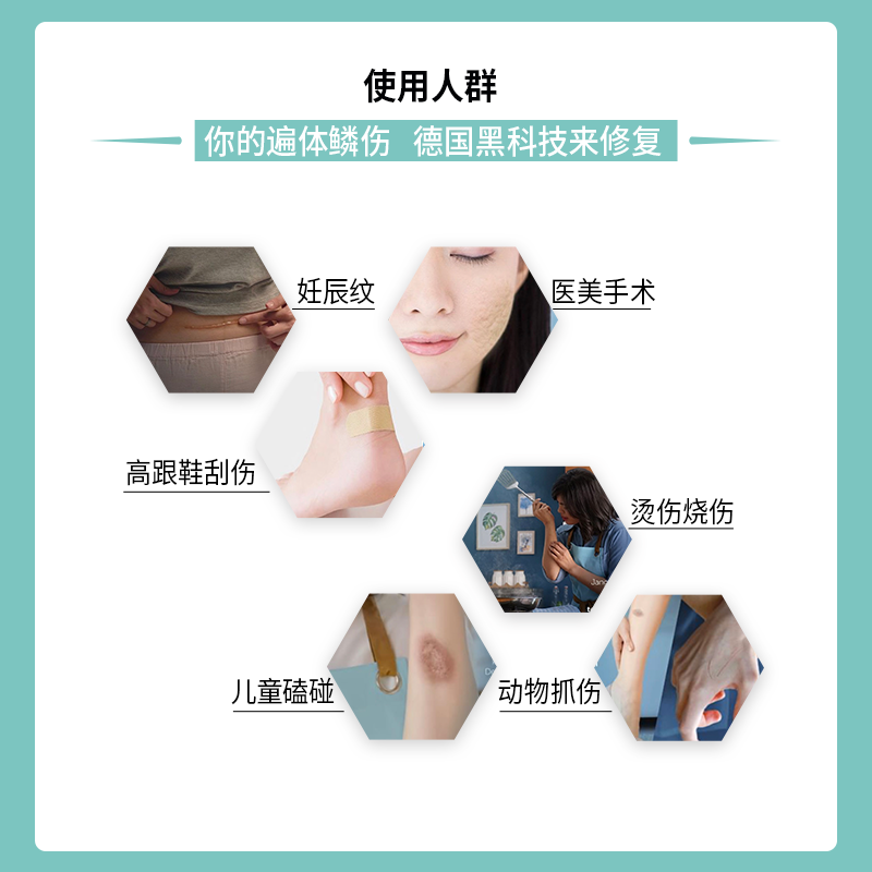可亿安德国孕妇剖腹产手术淡疤凝胶 cleverangel祛疤产品