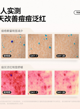 重磅新品红之温和抗痘洁面啫喱
