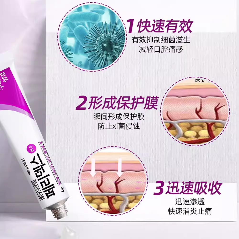 韩国peridex绿十字口腔溃疡膏上火起泡口疮专用药凝胶进口正品6g,淘宝优惠券,粉丝福利购,淘宝优惠卷