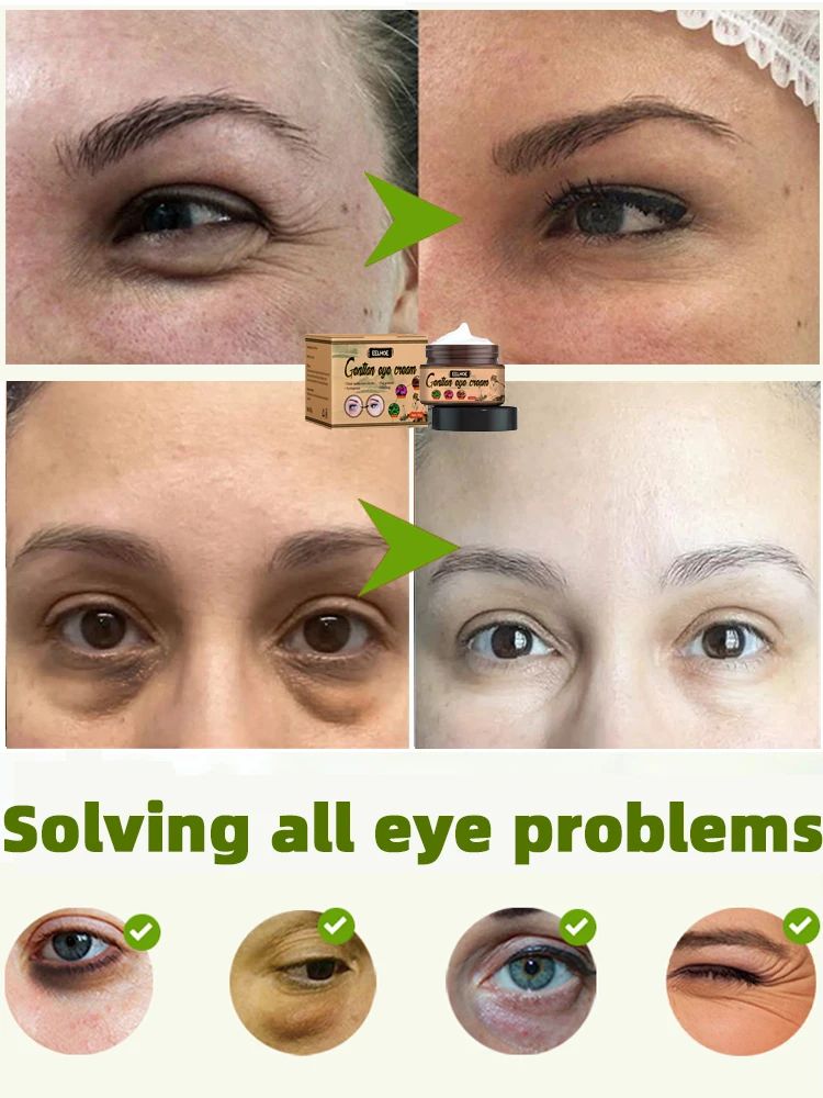 Anti-rugas Eye Cream, remover bolsas oculares, círculos esc - 图3