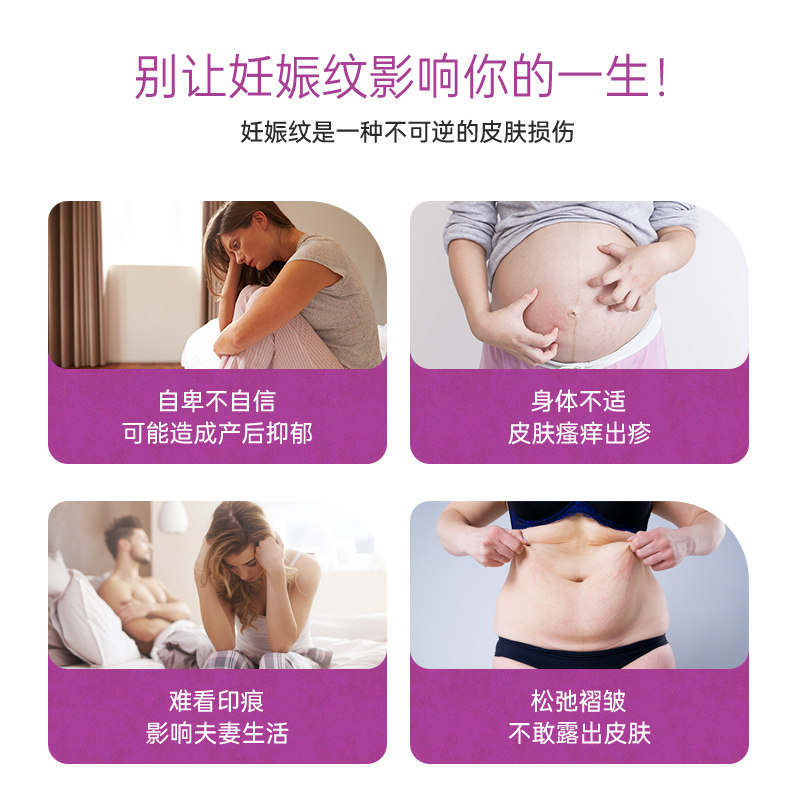stratamark施得美妊娠纹修护膏凝胶 康哲海外妊娠纹护理
