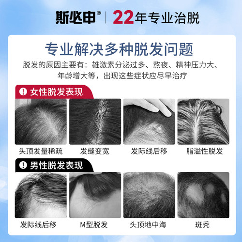 斯必申米诺地尔搽剂2%生发液防脱发女防脱生发液酊搽剂洗发水 - 图0