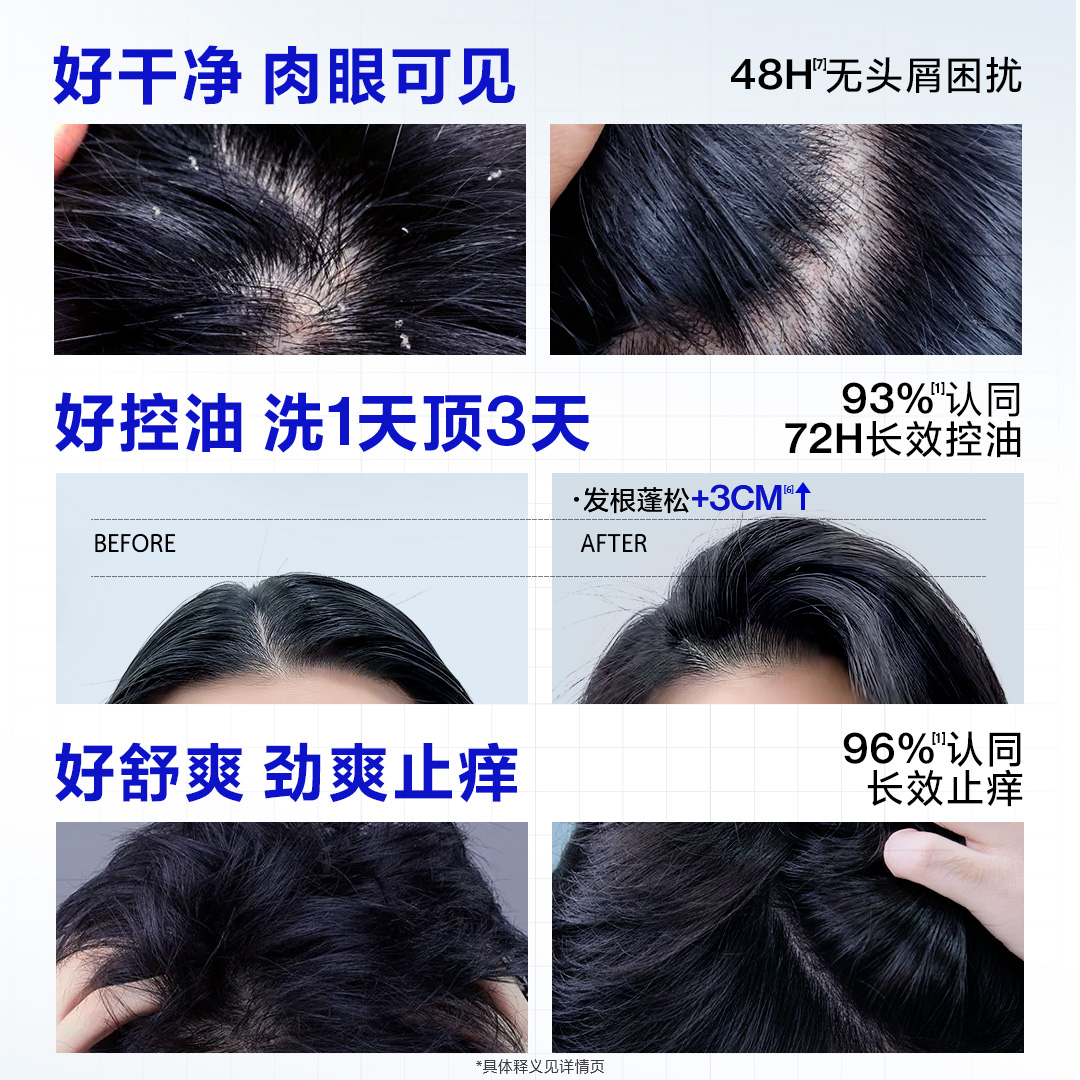 海洋至尊男士去屑止痒洗发水控油蓬松女洗头膏露官方旗舰店正品 - 图1