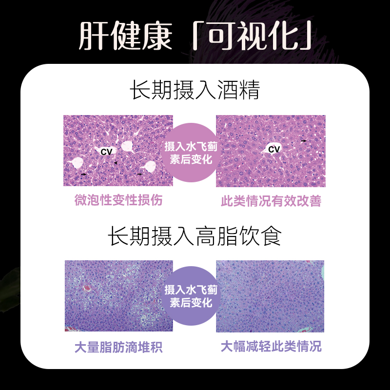 isdg奶蓟草护肝片日本进口水飞蓟胶囊保健养护加班熬夜应酬解酒片