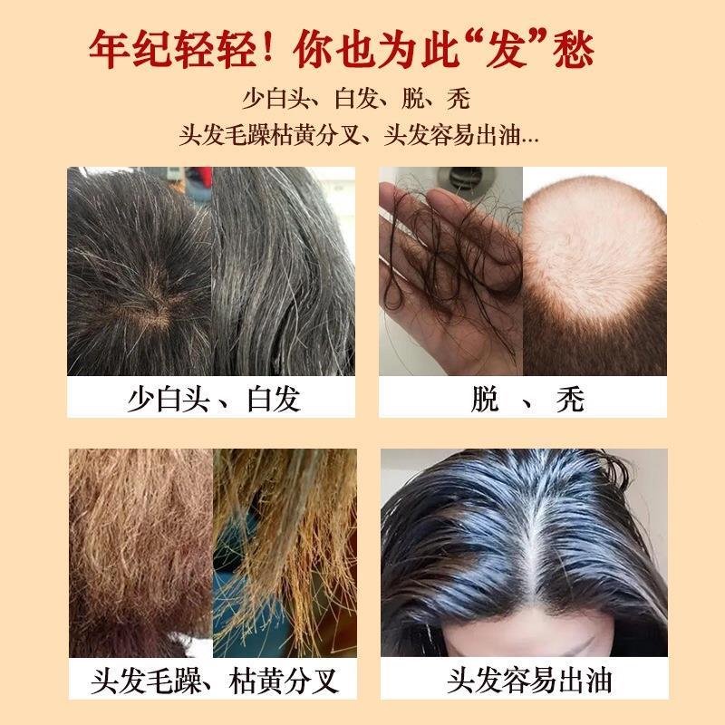 人参黄精桑葚茶乌根益生茶桑葚黑发茶养生茶叶男女黑芝麻黑豆花茶