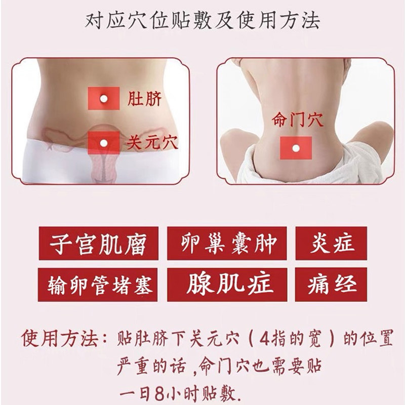 子宫肌瘤舒宫贴卵巢囊肿妇科炎症 飞纯度膏药贴（器械）