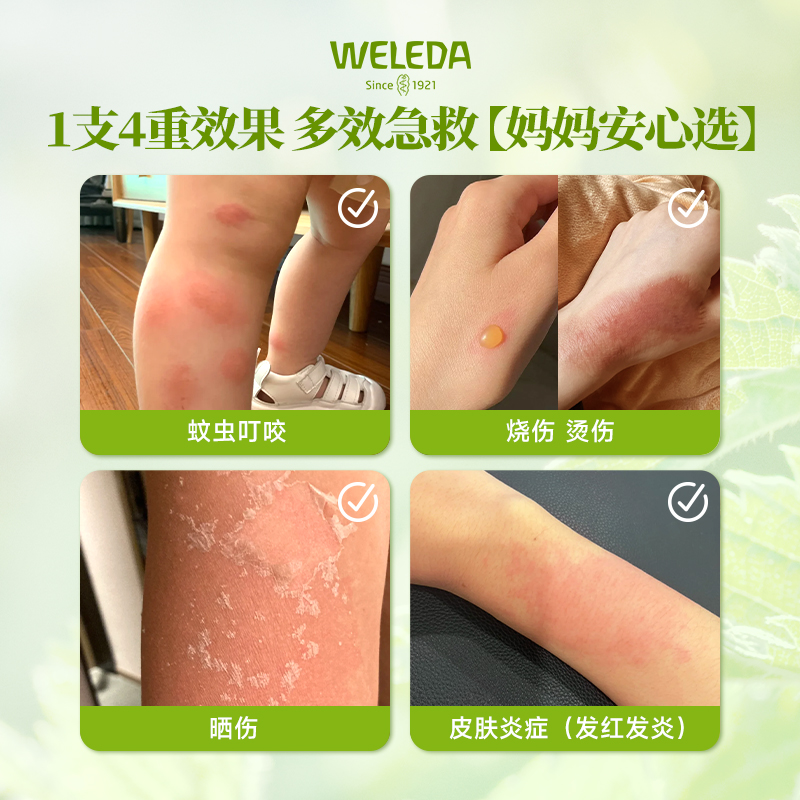 2件装Weleda维蕾德蚊虫叮咬止痒啫喱烧烫伤急救 芦荟鼻喷雾剂通鼻