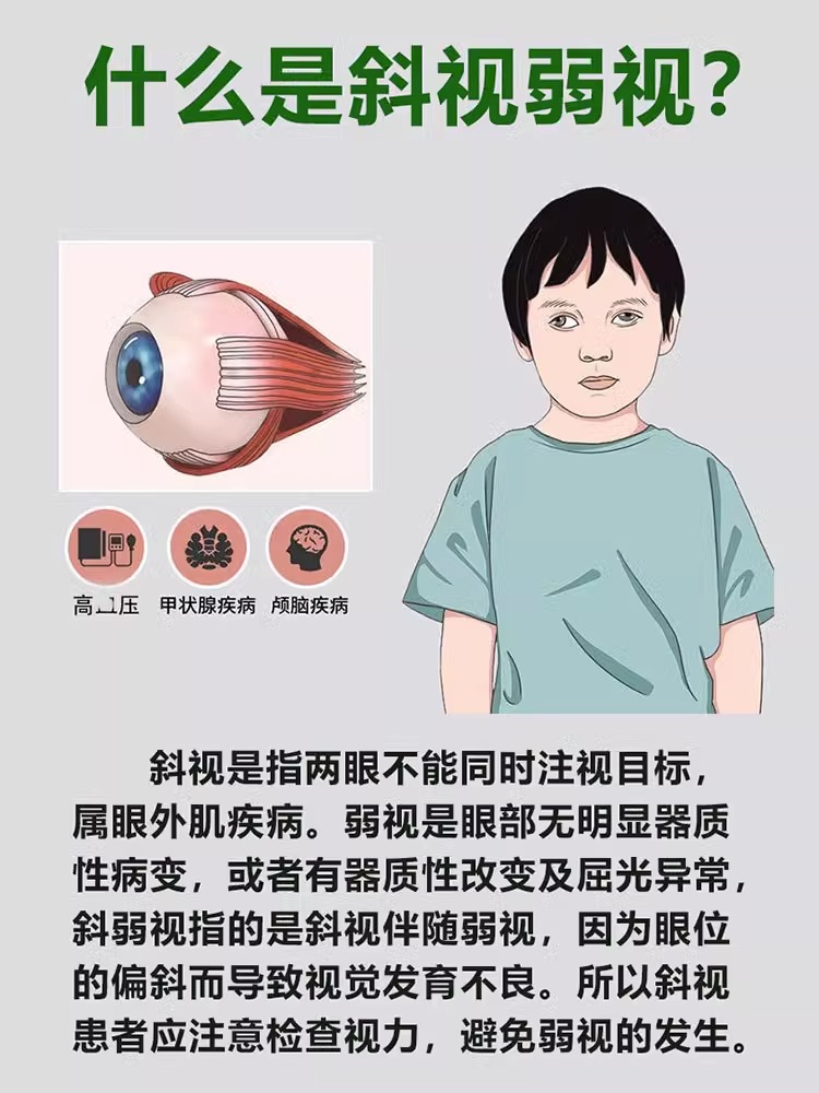 斜视矫正器训练器聚散球纠正眼睛内外斜视弱视斗鸡眼歪矫正眼斜贴 - 图1