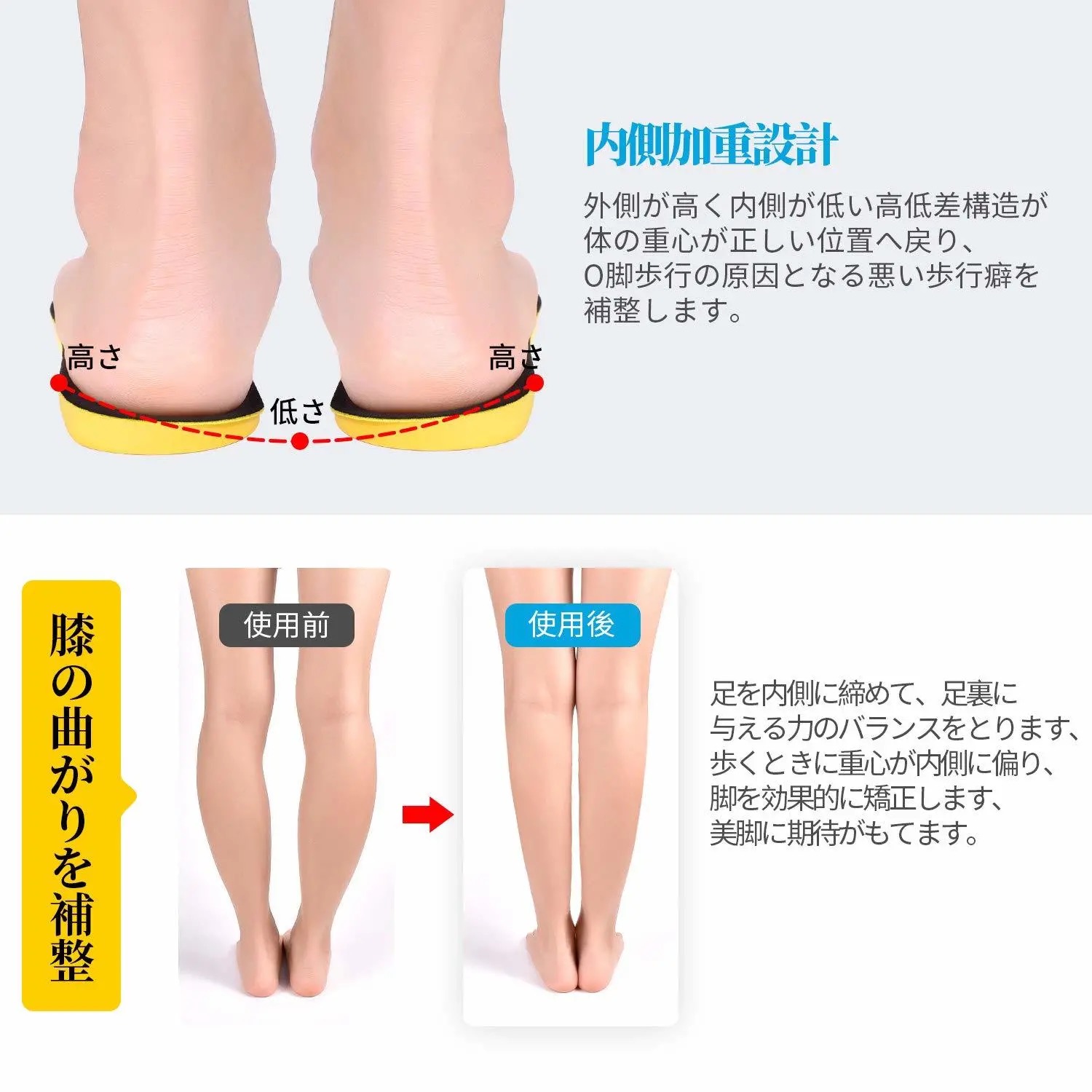 日本扁平足o型腿矫正鞋垫成人儿童小腿外翻外八字足内翻纠正鞋垫 - 图0
