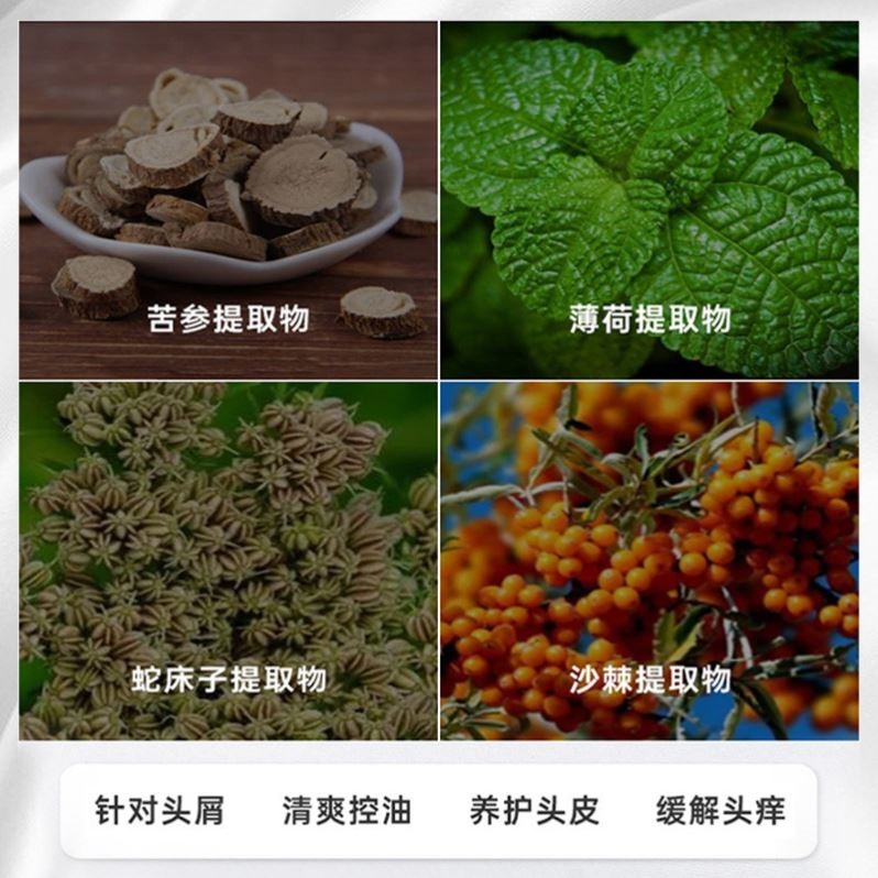 芙诗婷煤焦油洗剂洗发水头屑止痒控油去屑皮肤洗液官方旗舰店正品 - 图0