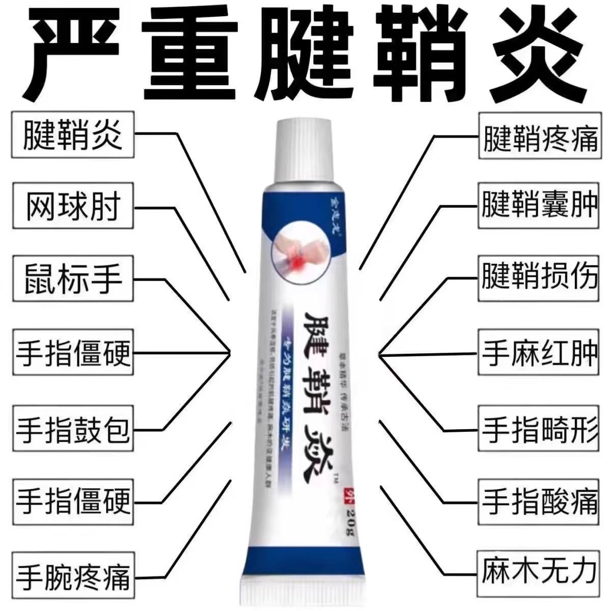 腱鞘炎手指手腕痛劳损扭伤筋骨疼痛消肿凝胶僵直麻木弹响鼓包 - 图0