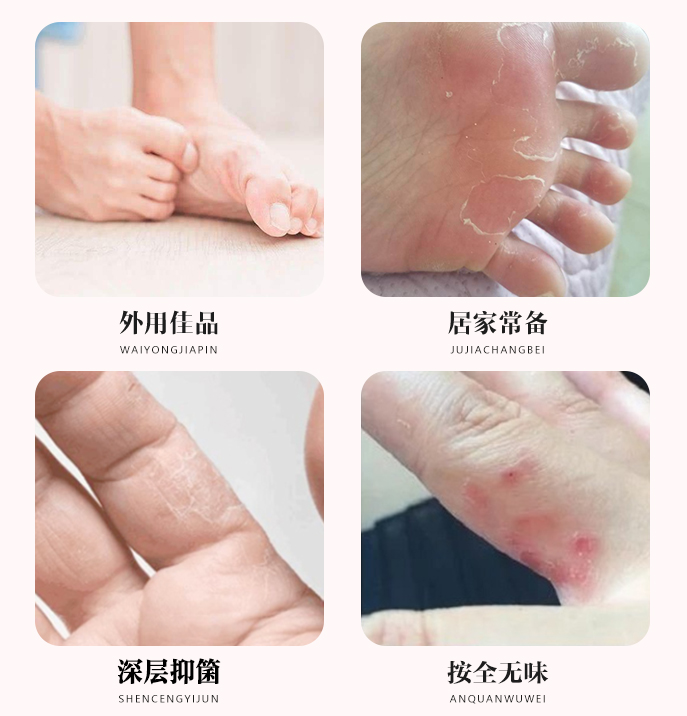 健源堂藏秘狼毒脚臭皮肤外用乳膏 健源堂皮肤消毒护理（消）