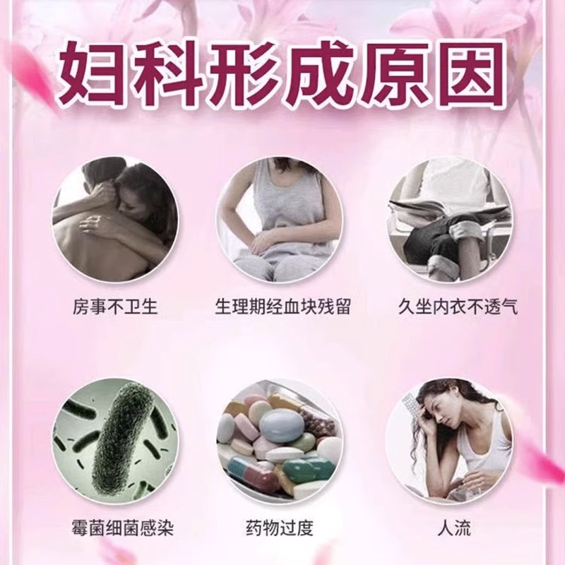 XC金雞婦科凝膠抑菌陰道私處霉菌止癢去私處去異味黃多女外陰瘙癢_穩耐醫療器械旗艦店_成人用品/情趣用品