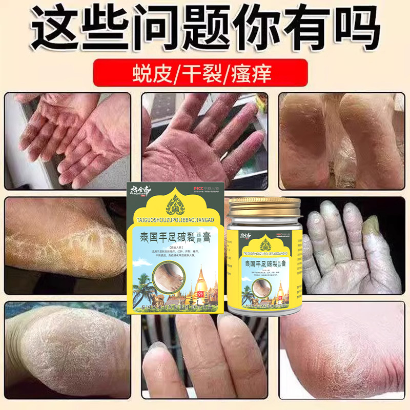 泰国腰腿颈肩膝盖跌打损伤关节颈椎手足成人中老年可用27款合集F