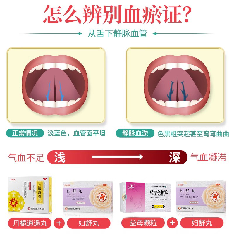 昆中药妇舒丸10袋补气养血月经调理宫寒痛经白带异常妇科用药正品-图0