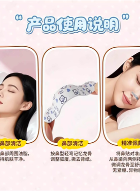 日式塑翘鼻贴缩鼻翼矫正高鼻梁