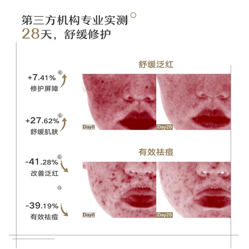 auou艾遇清洁面膜女深层清洁涂抹式泥膜吸附油脂废角质收缩毛孔