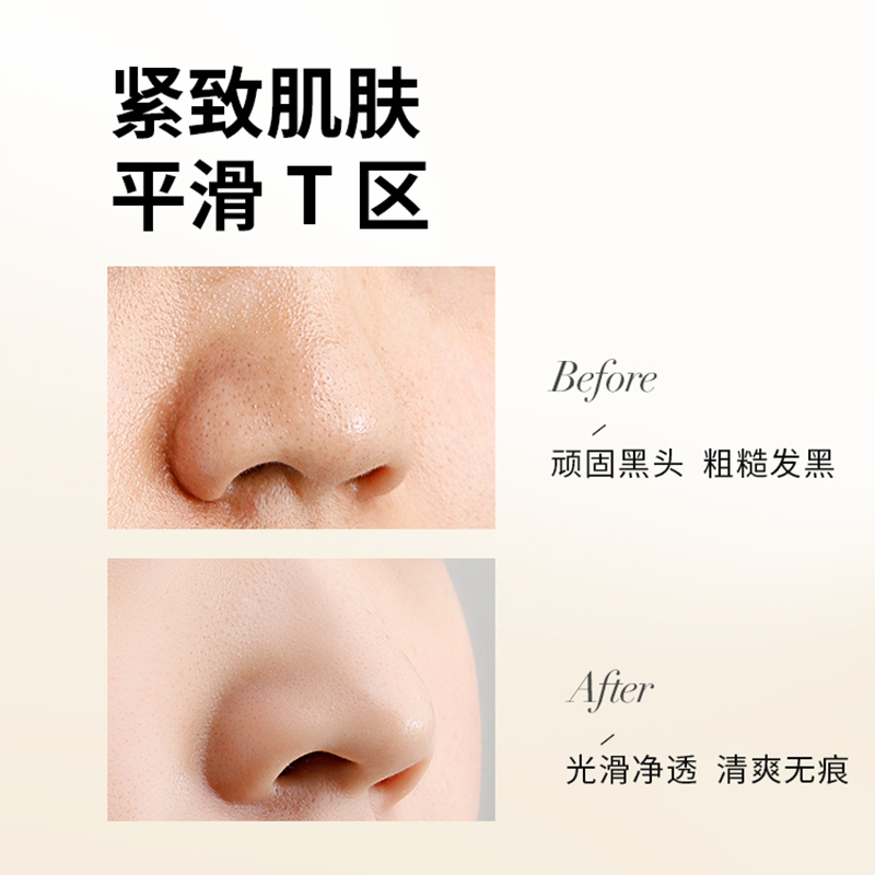 UODO鼻贴黑头粉刺清洁导出液黑头贴优沃朵正品官方旗舰店