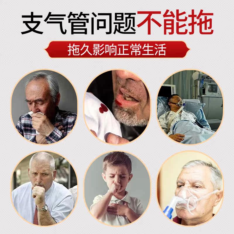 变异性嗓子特干咳效支气管炎磁疗贴 新驰医疗器械膏药贴（器械）