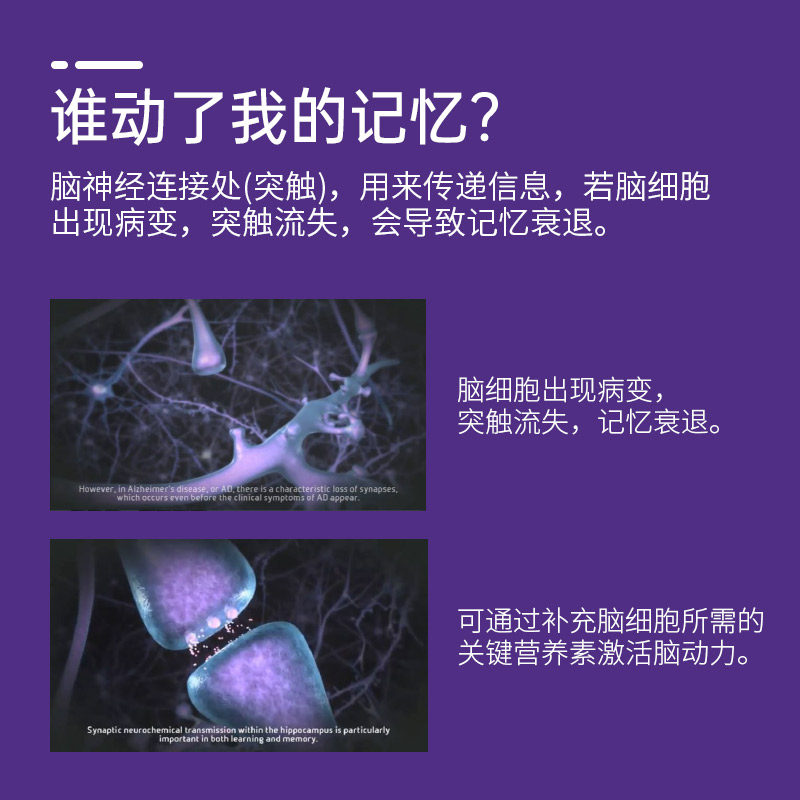 纽迪希亚智敏捷souvenaid营养品 纽迪希亚营养食品海外旗舰功能饮料饮品