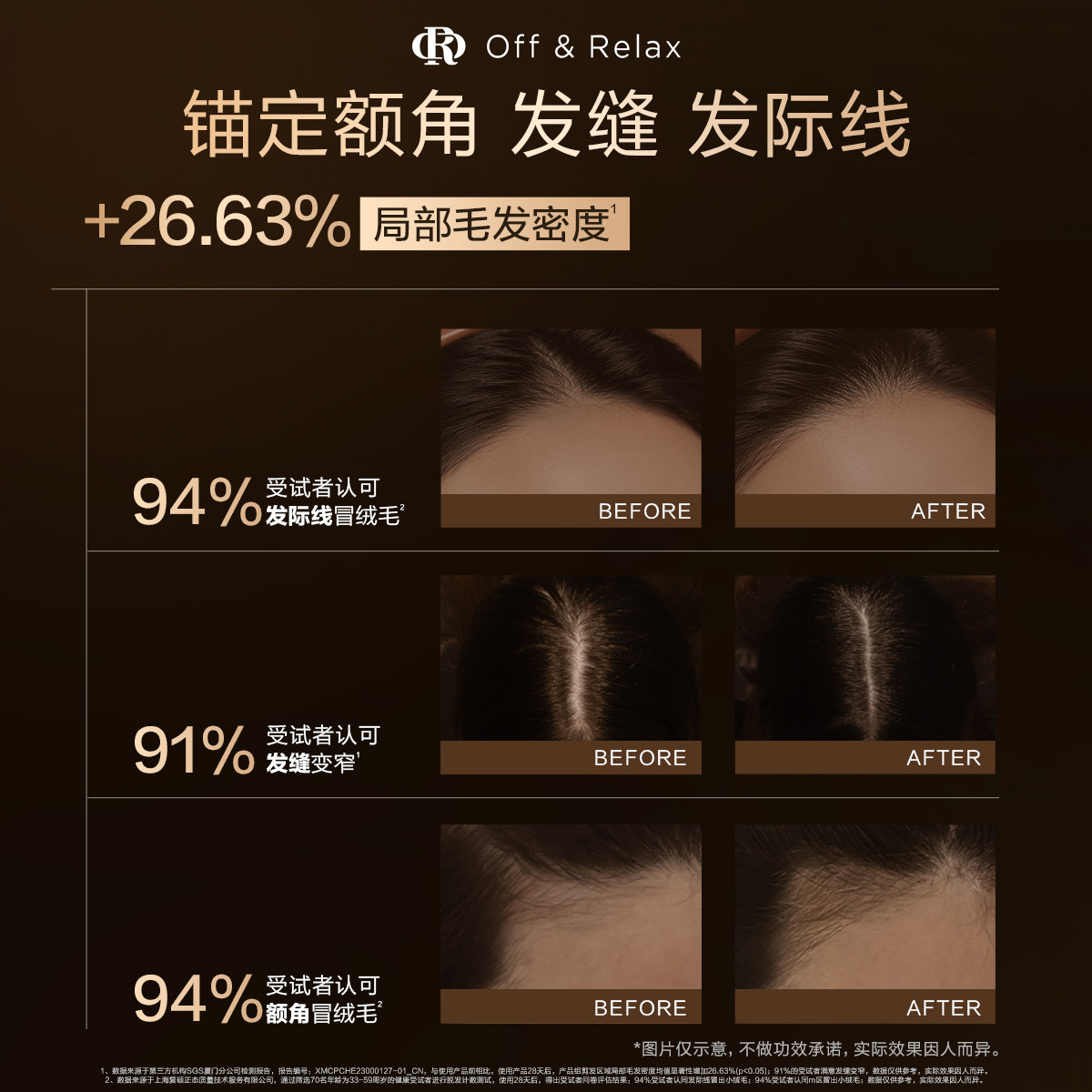 【618立抢】OffRelax防脱育发超活喷雾头皮精华固发密发防掉发